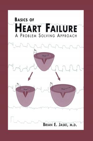 Cover of the book Basics of Heart Failure by J. E. Meade