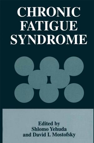 Cover of the book Chronic Fatigue Syndrome by Fred Punzo