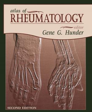 Cover of Atlas of Rheumatology