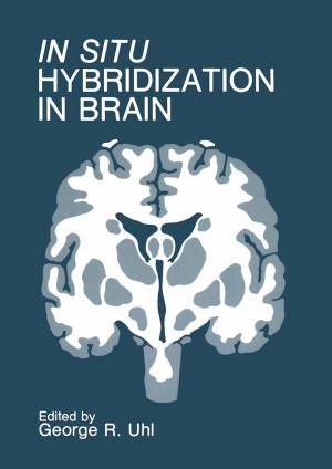 Cover of the book In Situ Hybridization in Brain by Robert W. Summers, Jeffrey L. Conklin, Frederick C. Johlin, Joseph A. Murray, Konrad S. Schulze