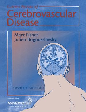 Cover of the book Current Review of Cerebrovascular Disease by 