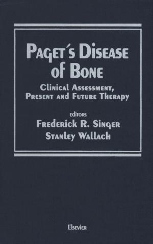 Cover of the book Paget’s Disease of Bone by Mens en Ruimte