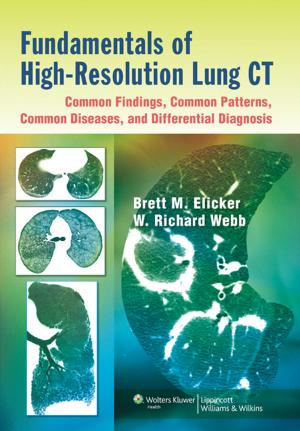 Book cover of Fundamentals of High-Resolution Lung CT: Common Findings, Common Patterns, Common Diseases, and Differential Diagnosis