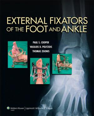 Cover of the book External Fixators of the Foot and Ankle by Caren Greenstein