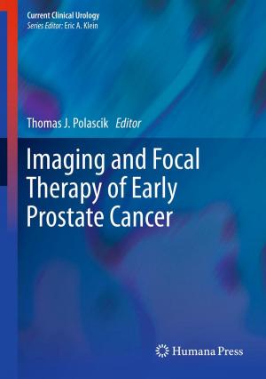 Cover of the book Imaging and Focal Therapy of Early Prostate Cancer by Thomas M. Blake