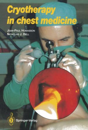 Book cover of Cryotherapy in Chest Medicine