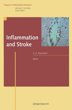Cover of the book Inflammation and Stroke by SHIMAZAKI, STUART