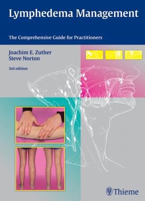 Cover of the book Lymphedema Management by Baljendra S. Kapoor, Jonathan M. Lorenz