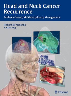 Cover of the book Head and Neck Cancer Recurrence by Michael Schuenke, Erik Schulte, Udo Schumacher