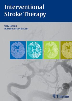 Book cover of Interventional Stroke Therapy