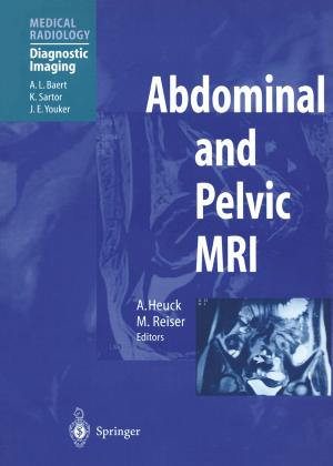 Cover of the book Abdominal and Pelvic MRI by Mahmood Aliofkhazraei