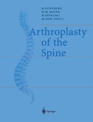 Cover of the book Arthroplasty of the Spine by Rafael M. Trommer, Carlos P. Bergmann