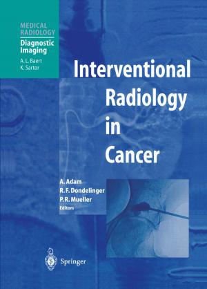 Cover of the book Interventional Radiology in Cancer by José Ramiro Martínez-de Dios, Alberto de San Bernabé-Clemente, Arturo Torres-González, Anibal Ollero