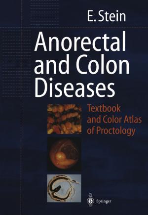Cover of the book Anorectal and Colon Diseases by Klaus Lucke, Horst Laqua