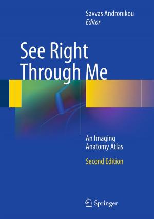 Cover of the book See Right Through Me by Björn Christensen, Sören Christensen