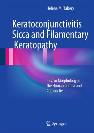 Cover of the book Keratoconjunctivitis Sicca and Filamentary Keratopathy by Joachim Heintze