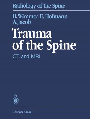 Book cover of Trauma of the Spine
