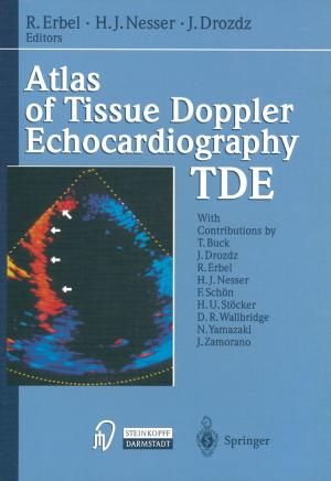 Cover of the book Atlas of Tissue Doppler Echocardiography — TDE by Ludwig Pohl, D. Demus, G. Pelzl, Heino Finkelmann, Karl Hiltrop, Martin Schadt