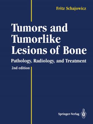 Cover of the book Tumors and Tumorlike Lesions of Bone by Uwe Hecker, Eric Meier