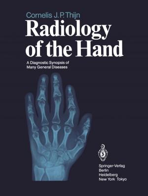 Book cover of Radiology of the Hand