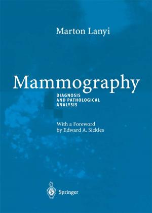 Cover of the book Mammography by Inge Seiffge-Krenke