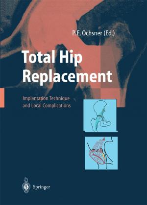 Cover of the book Total Hip Replacement by Peter Thilo Hasler