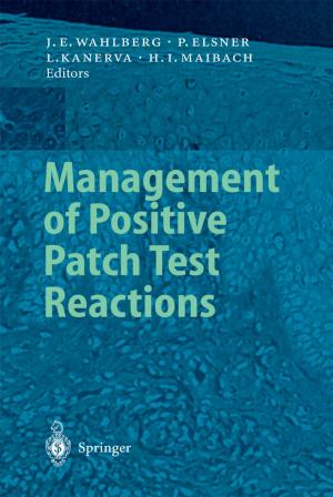 Cover of the book Management of Positive Patch Test Reactions by Emil Brujan