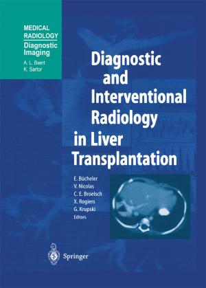bigCover of the book Diagnostic and Interventional Radiology in Liver Transplantation by 