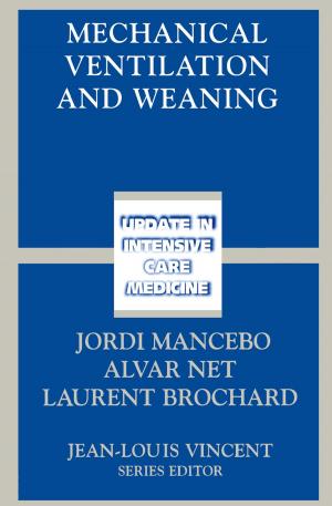 Cover of the book Mechanical Ventilation and Weaning by Xianzhi Zhang