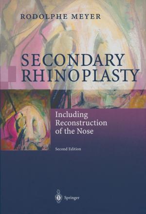 Cover of the book Secondary Rhinoplasty by Christian Demant, Bernd Streicher-Abel, Carsten Garnica