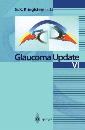 Cover of the book Glaucoma Update VI by J. Sievers, A. Raedler