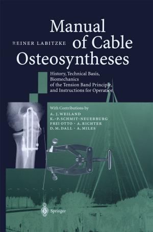 Cover of the book Manual of Cable Osteosyntheses by Jens Nävy
