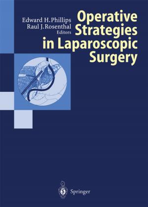 Cover of the book Operative Strategies in Laparoscopic Surgery by Thomas Lenarz, Hans-Georg Boenninghaus