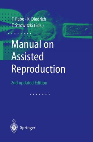 Cover of the book Manual on Assisted Reproduction by 
