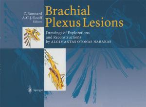 Cover of the book Brachial Plexus Lesions by Deng-Feng Li