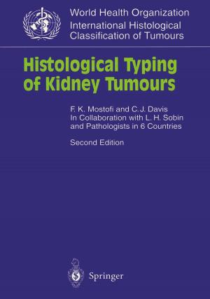Cover of the book Histological Typing of Kidney Tumours by Jan C. Joerden