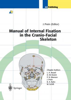 Cover of the book Manual of Internal Fixation in the Cranio-Facial Skeleton by Karsten Balzer, Michael Bonitz