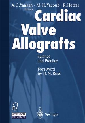 Cover of the book Cardiac Valve Allografts by N. Gschwend, J. Winer, A. Böni, W. Busse, R. Dybowski, J. Zippel