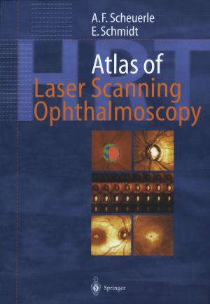 Book cover of Atlas of Laser Scanning Ophthalmoscopy
