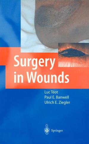 Cover of the book Surgery in Wounds by Stefano Bellucci, Bhupendra Nath Tiwari, Neeraj Gupta