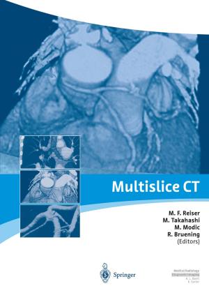Cover of the book Multislice CT by Martin Hussels