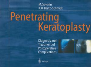 Cover of the book Penetrating Keratoplasty by Dagmar Seitz, Joanna Konopinski, Nina Konopinski-Klein