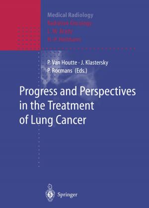 Cover of the book Progress and Perspective in the Treatment of Lung Cancer by Christophe Chorro, Dominique Guégan, Florian Ielpo
