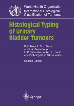 Cover of the book Histological Typing of Urinary Bladder Tumours by J.H. Abicht, W. Bähren, G.A. Broderick, H. Gall, I. Goldstein, P.M. Hanno, U. Hartmann, D. Hauri, M.W. Hengeveld, R.D. Hesch, G. Holzki, Udo Jonas, K.-P. Jünemann, F. Kulvelis, R.M. Levin, F.J. Levine, T.F. Lue, W. Scherb, T.H. Schürmeyer, C. Sparwasser, J. Staubesand, W.D. Steers, Christian Stief, K. Van Arsdalen, G. Wagner, A.J. Wein, E. Wespes, U. Wetterauer, W.F. Thon