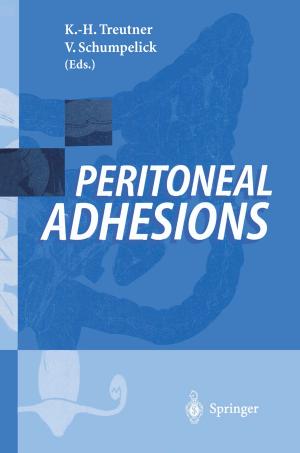 Cover of the book Peritoneal Adhesions by 