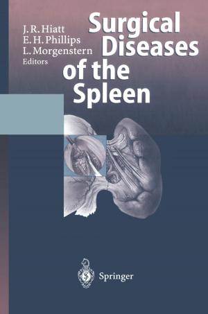 Cover of the book Surgical Diseases of the Spleen by Tadamasa Shida
