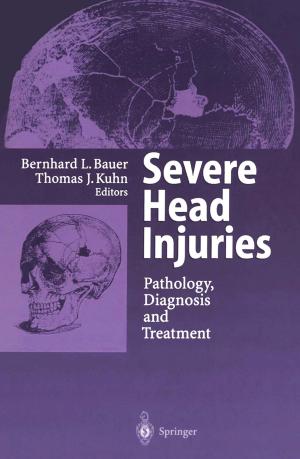 Cover of the book Severe Head Injuries by Žarko Filipović