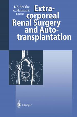 Cover of the book Extracorporeal Renal Surgery and Autotransplantation by Steffen Paul, Reinhold Paul