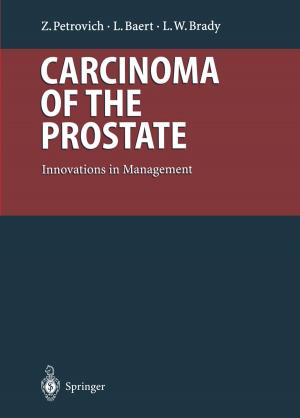 Cover of the book Carcinoma of the Prostate by Klaus Hahn, J. Guillet, A. Piepsz, Sibylle Fischer, I. Roca, Isky Gordon, M. Wioland