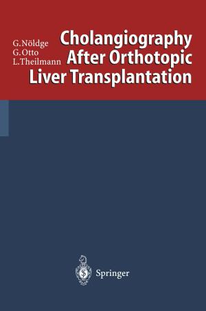 Cover of the book Cholangiography After Orthotopic Liver Transplantation by Yujun Feng, Zonglin Chu, Cécile A. Dreiss